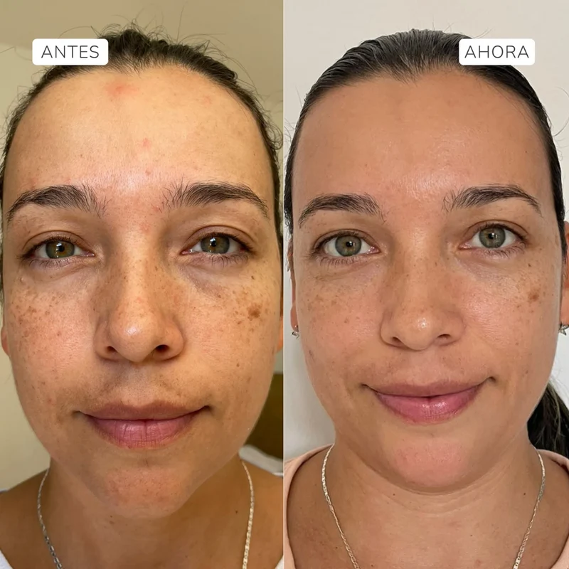 Suero facial Fito Retinol - Aruná