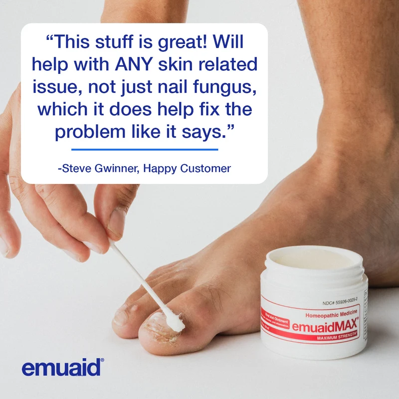 EMUAIDMAX para hongos en las uñas - Alivio de acción rápida