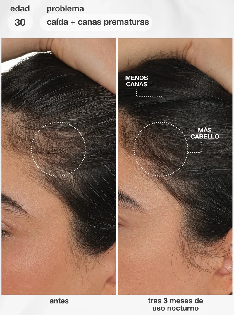 K18 FutureIQ™ Biomimetic Hair Longevity Serum | Pack 3 meses (3 x 90ml)