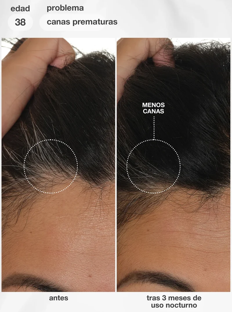 K18 FutureIQ™ Biomimetic Hair Longevity Serum | Pack 3 meses (3 x 90ml)